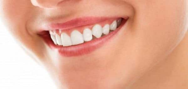 خلطات لتبيض الأسنان
